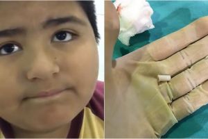 Telan peluit, bocah ini kalau bernapas menyemprit