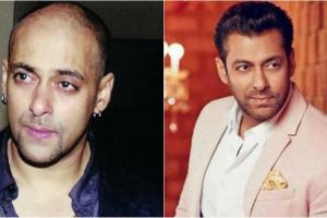 Potret 10 aktor Bollywood sebelum vs sesudah transplantasi rambut