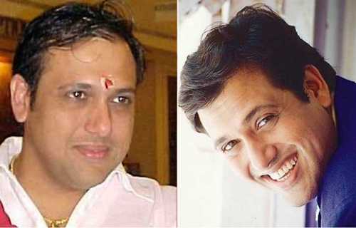 Potret 10 aktor Bollywood sebelum vs sesudah transplantasi rambut