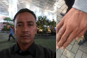 Tangan helper Bandara Soetta ini sampai  bengkak gara-gara menolak tip