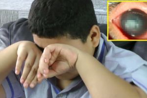 Tak sengaja garuk kornea mata, bocah ini terancam buta