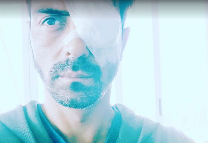 10 Seleb India ini pernah cedera serius pas syuting, ada yang amnesia