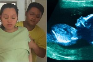 Inginkan anak laki-laki, pasangan suami istri ini nekat aborsi bayinya