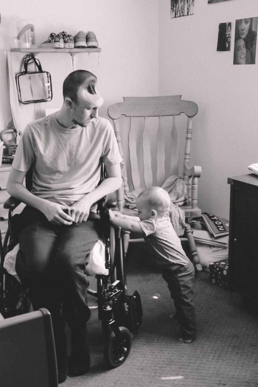 Curhatan pilu istri dampingi suami yang kehilangan kepala bagian depan