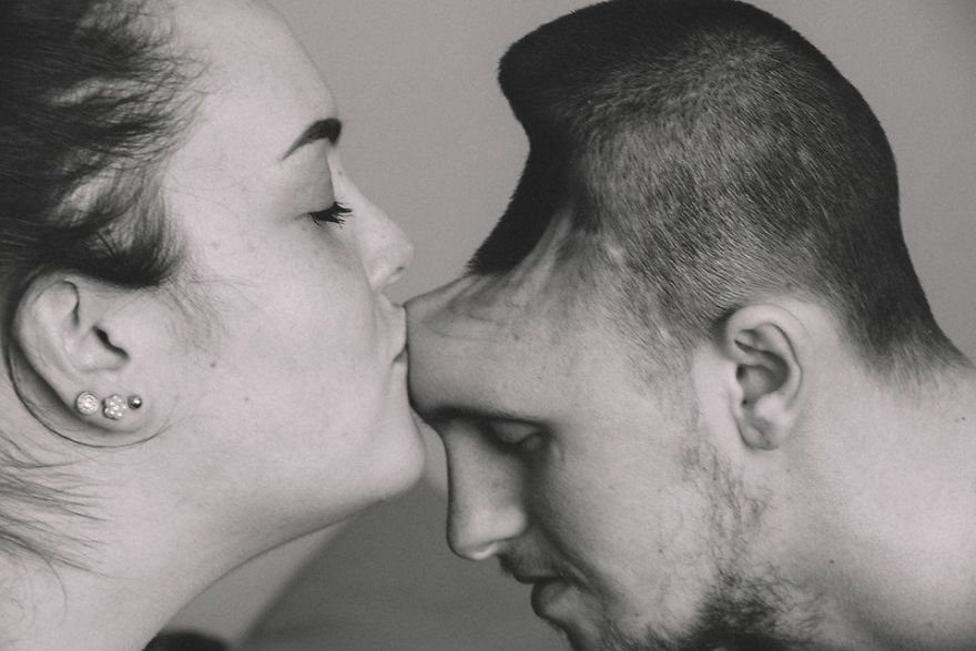 Curhatan pilu istri dampingi suami yang kehilangan kepala bagian depan