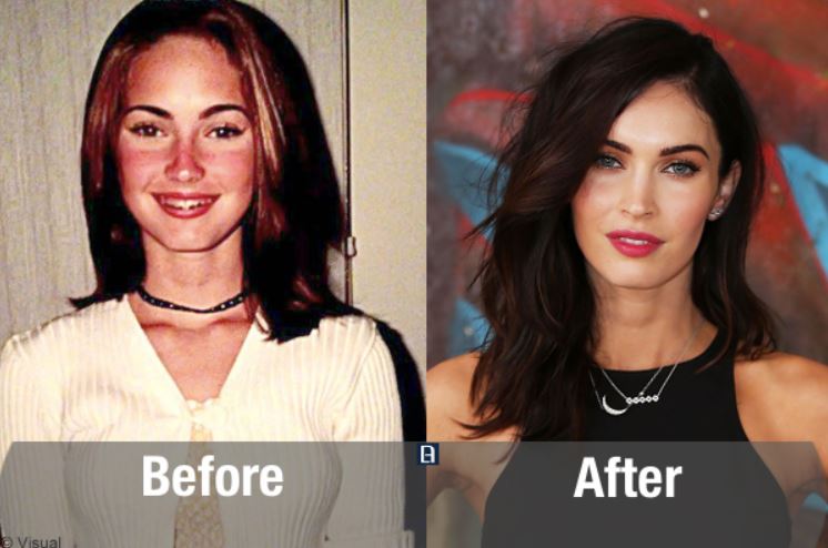 Transformasi ekstrem 10 seleb cantik Hollywood sebelum & sesudah oplas