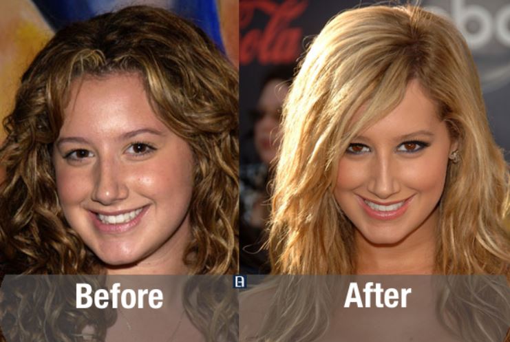 Transformasi ekstrem 10 seleb cantik Hollywood sebelum & sesudah oplas