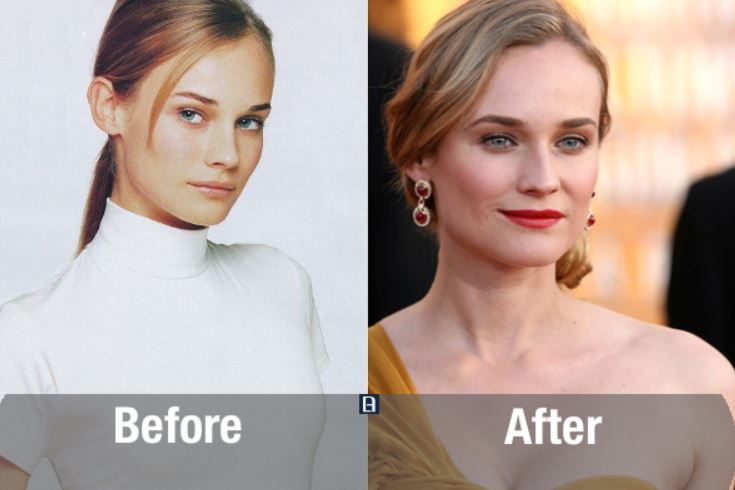 Transformasi ekstrem 10 seleb cantik Hollywood sebelum & sesudah oplas