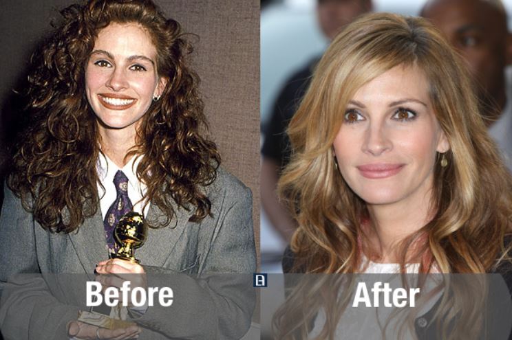 Transformasi ekstrem 10 seleb cantik Hollywood sebelum & sesudah oplas