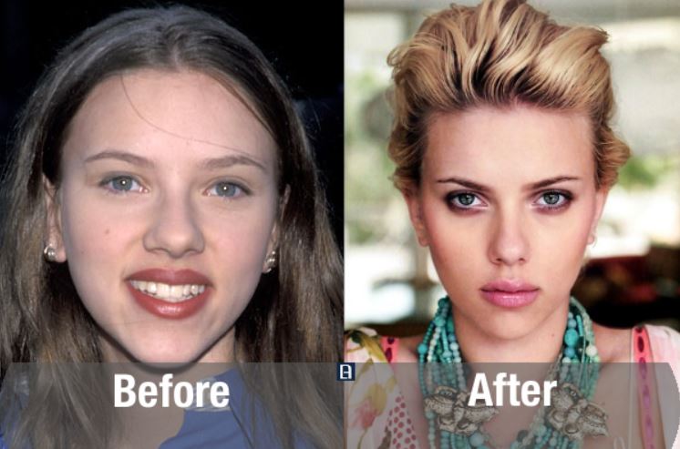 Transformasi ekstrem 10 seleb cantik Hollywood sebelum & sesudah oplas