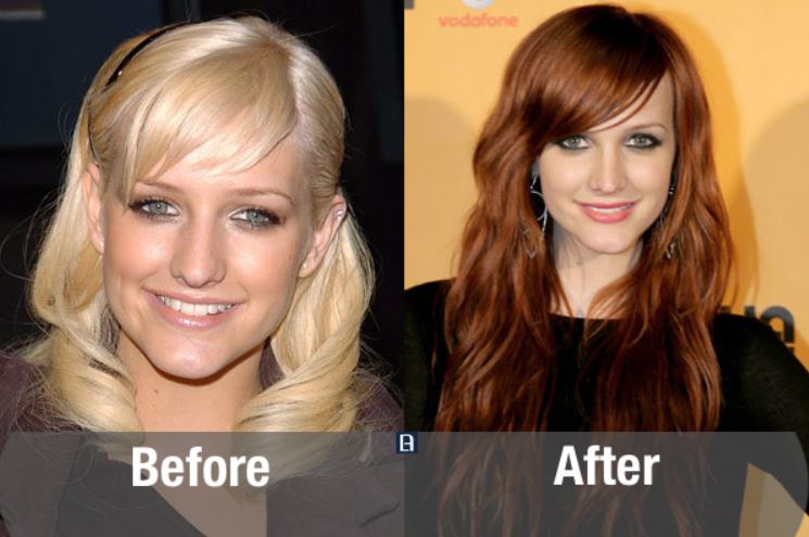 Transformasi ekstrem 10 seleb cantik Hollywood sebelum & sesudah oplas