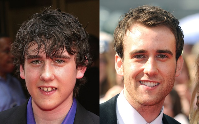 Transformasi wajah 5 seleb cowok ini drastis banget, bikin pangling 