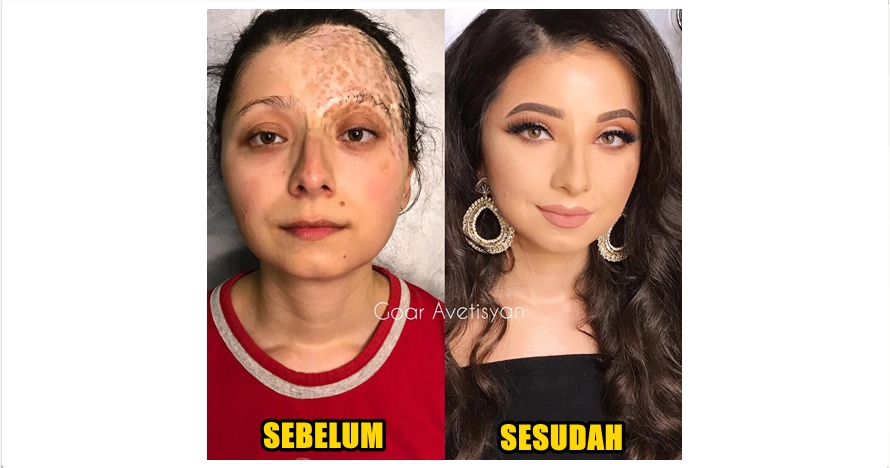 Transformasi ajaib makeup 10 cewek penderita kanker & kelainan kulit