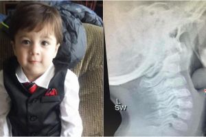 Telan anggur dan tersedak, bocah ini meninggal di hadapan ibunya