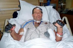 Gara-gara tangan digigit kucing, pria ini hampir kehilangan nyawa