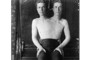 12 Pemain sirkus ini punya kelebihan yang bikin mata terbelalak