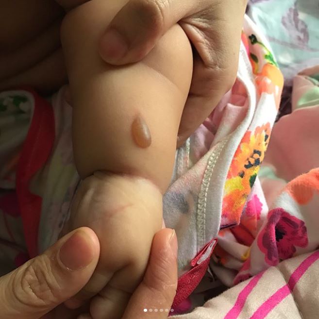 Anak artis ini alami luka bakar saat ikut belanja di toko tas branded