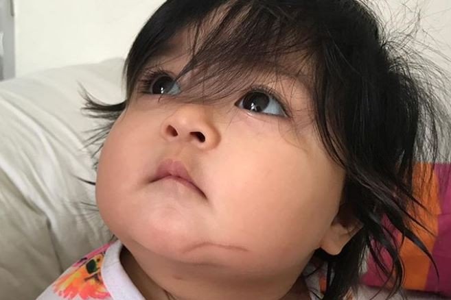 Anak artis ini alami luka bakar saat ikut belanja di toko tas branded