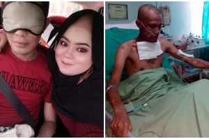 Kisah setia sang istri merawat suami yang kulit tubuhnya mengelupas