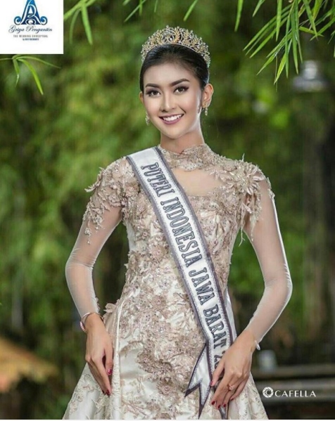 7 Gaya Kevin Lilliana di berbagai kontes kecantikan