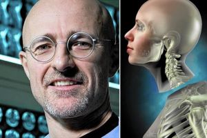 Sukses transplantasi kepala mayat, dokter ini coba pada kepala manusia