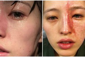 Kesemprot parfum ruangan, wajah wanita ini rusak dalam waktu 10 menit