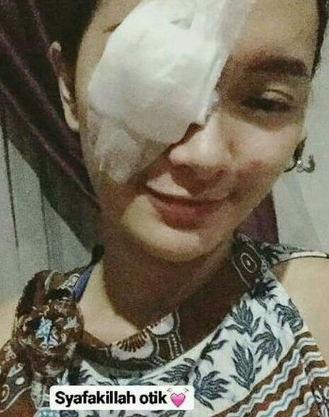 Mata kiri Zaskia Gotik diperban habis operasi, sakit apa ya?