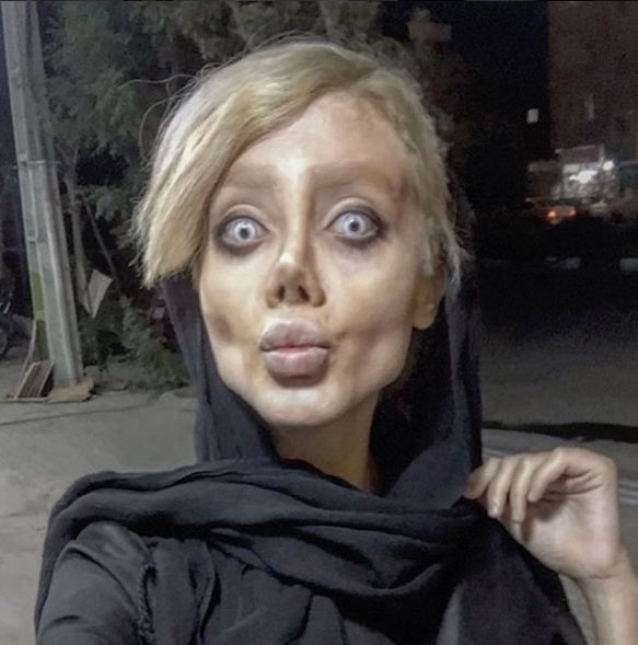 Gadis ini ingin mirip Angelina Jolie, malah berakhir seperti zombie