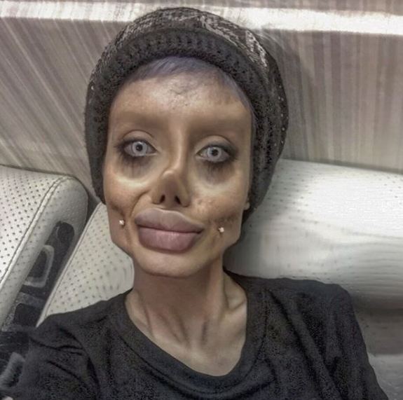 Gadis ini ingin mirip Angelina Jolie, malah berakhir seperti zombie