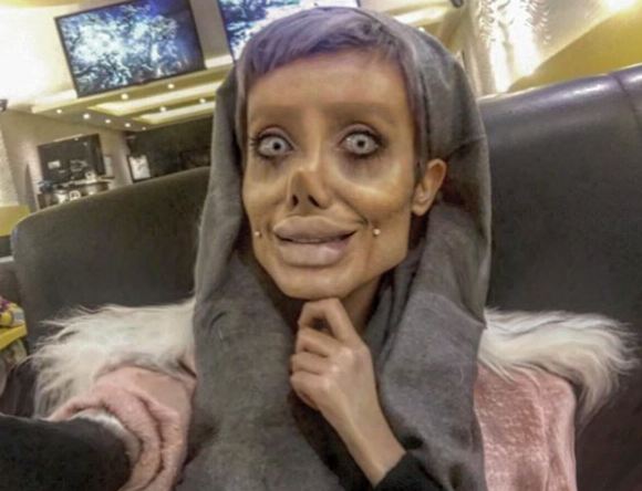 Gadis ini ingin mirip Angelina Jolie, malah berakhir seperti zombie