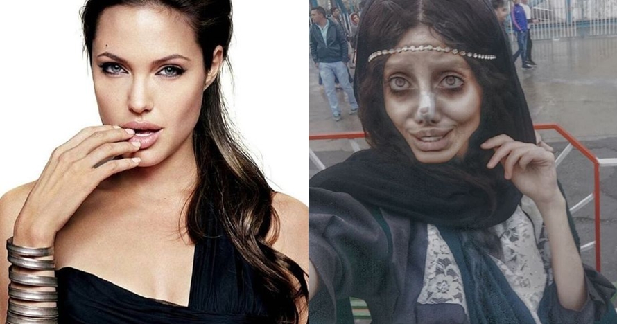 Gadis ini ingin mirip Angelina Jolie, malah berakhir seperti zombie