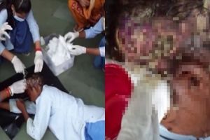 Gelandangan ini menangis kepalanya dimakan belatung, ngeri banget