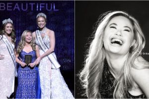 Penderita down syndrome ini sukses cetak sejarah di kontes kecantikan