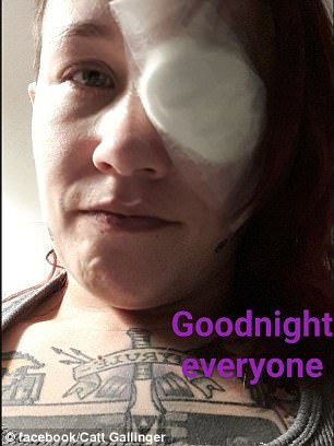 Nekat bikin tato di mata, gadis ini terancam alami buta permanen