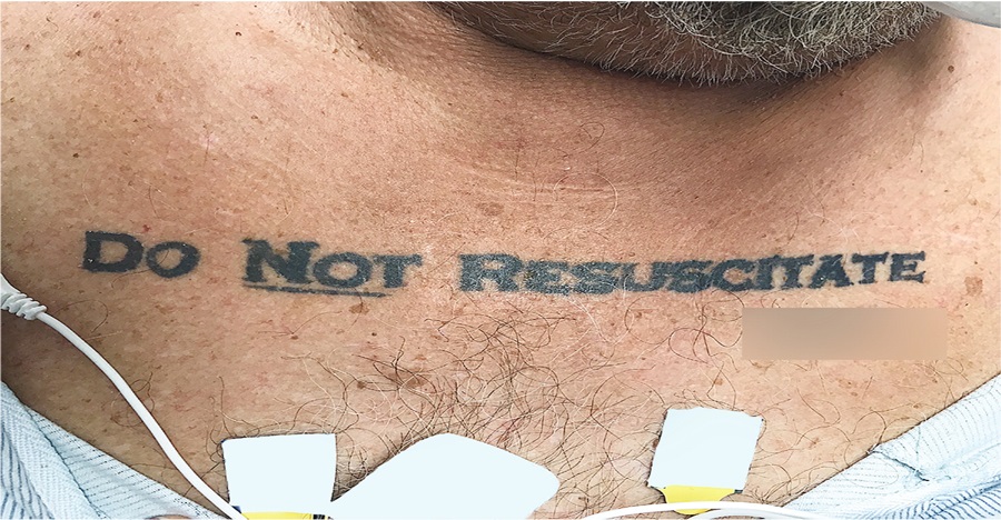 Gara-gara tulisan tato, dokter dibuat kebingungan tangani pasien ini