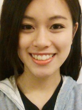 Sering diejek pacarnya, cewek ini rela 30 kali operasi plastik