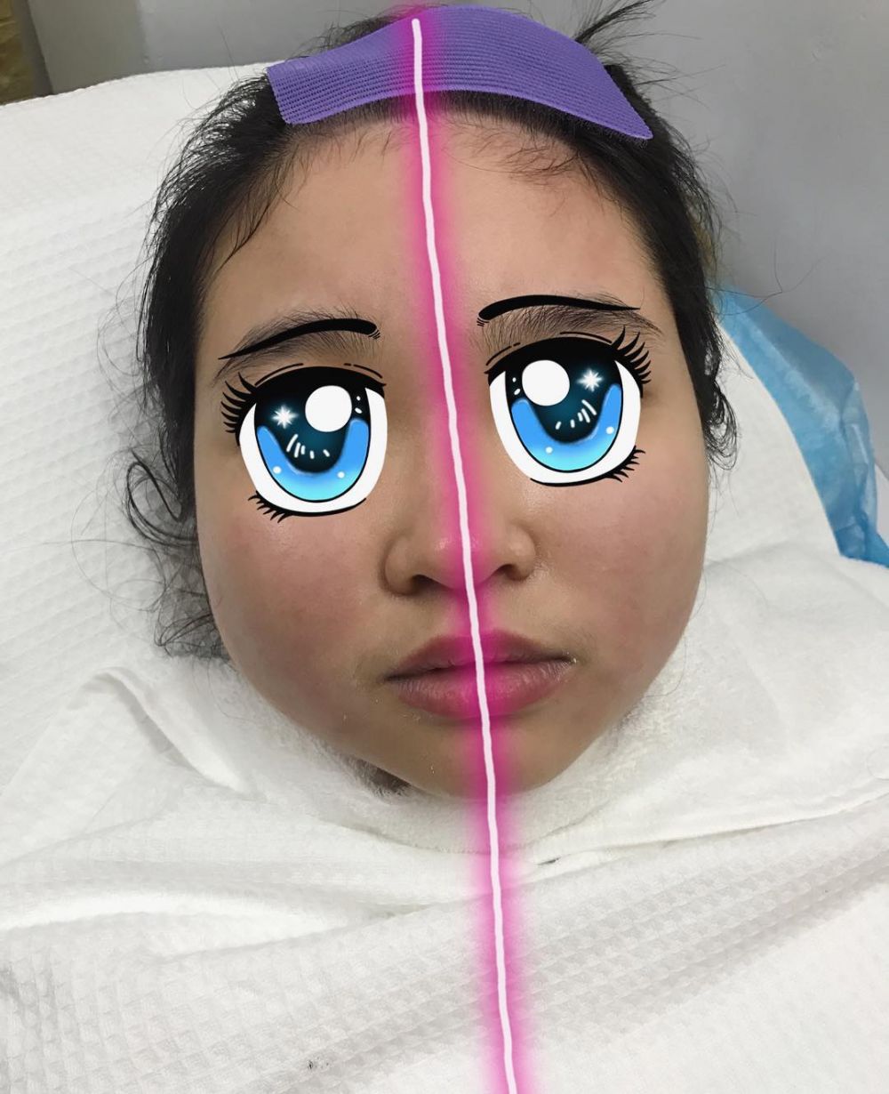 Sering diejek pacarnya, cewek ini rela 30 kali operasi plastik