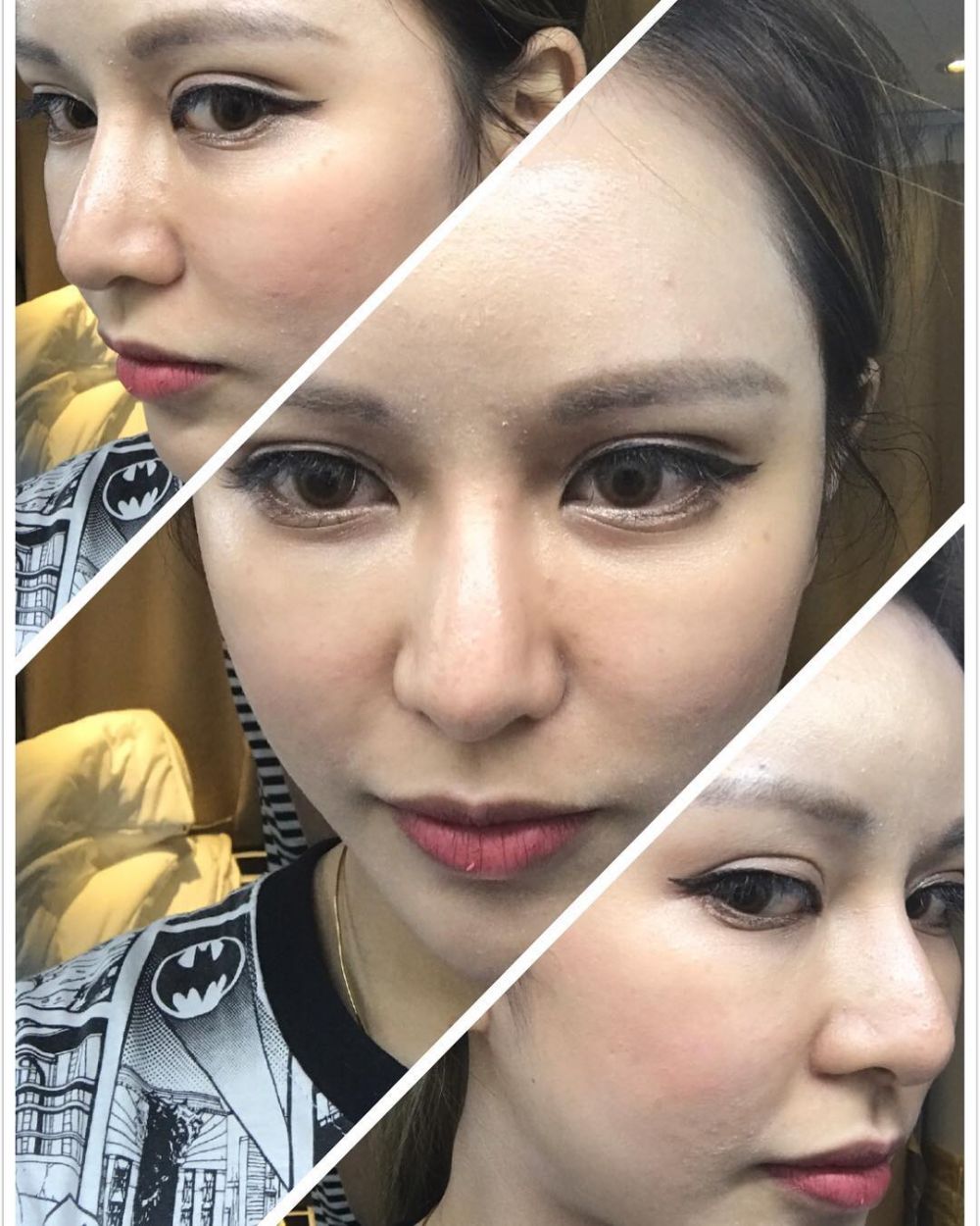 Sering diejek pacarnya, cewek ini rela 30 kali operasi plastik