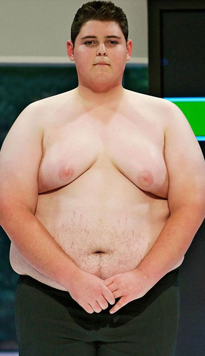 Berat badan turun 71 kg, transformasi cowok ini bikin syok