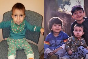 Alergi terhadap makanan, anak ini hanya bisa makan buah langka ini