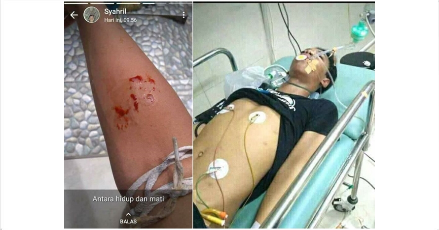 5 Orang ini tewas digigit ular kobra peliharaannya sendiri 