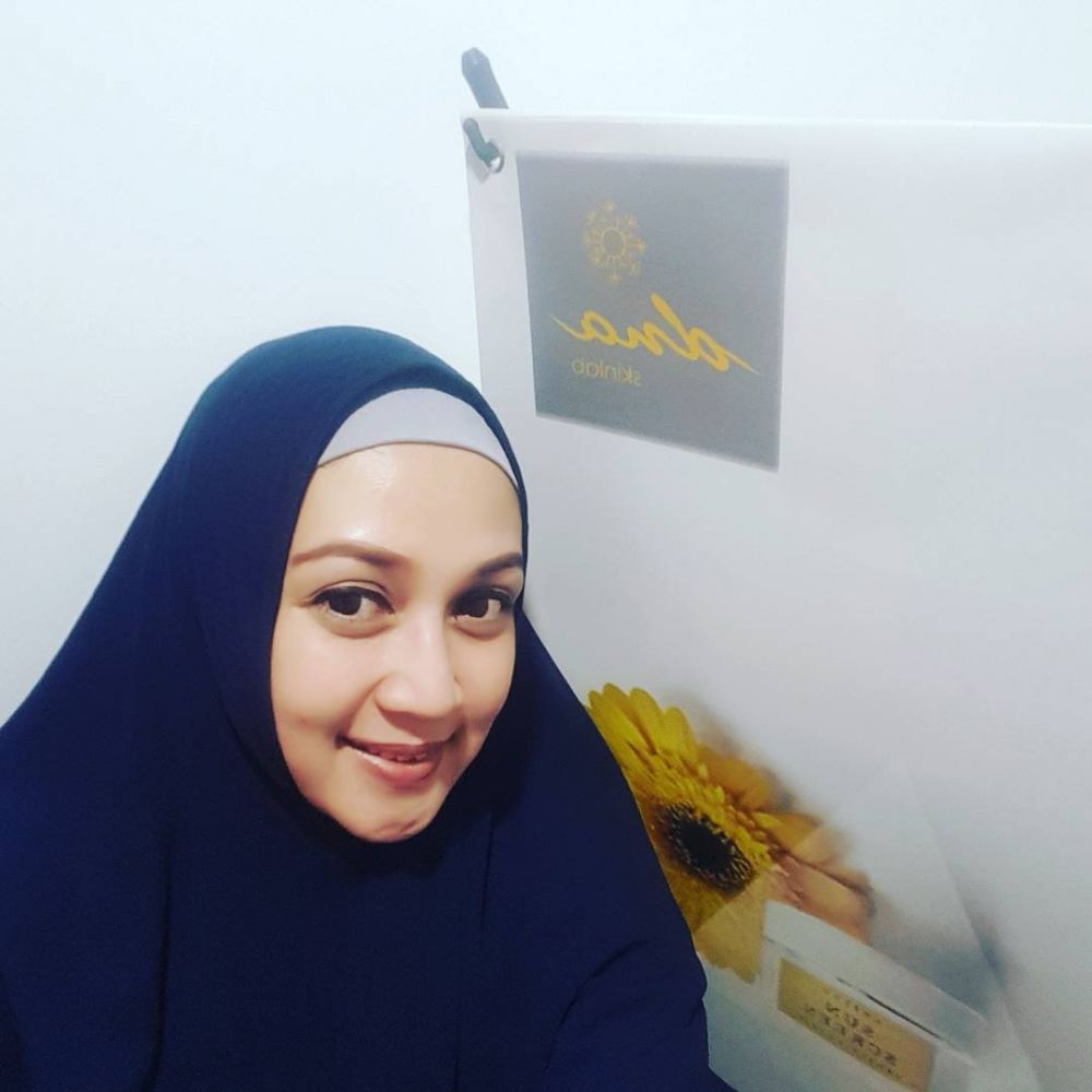 8 Potret terbaru Dina Lorenza, artis cantik dan hits era 2000-an