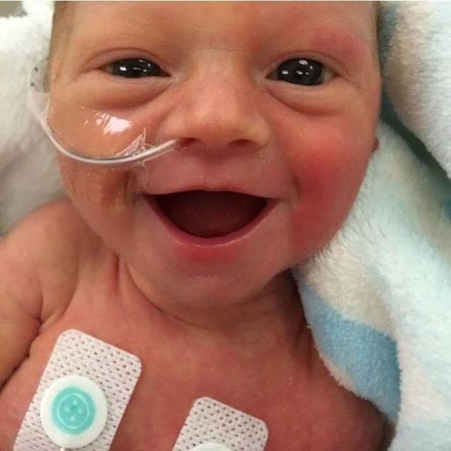 13 Potret bayi prematur yang tersenyum lebar ini bukti mereka kuat