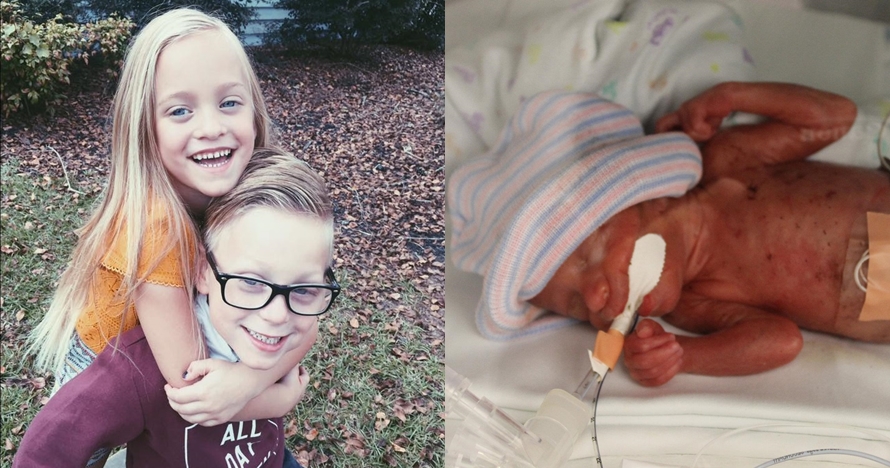 13 Potret bayi prematur yang tersenyum lebar ini bukti mereka kuat