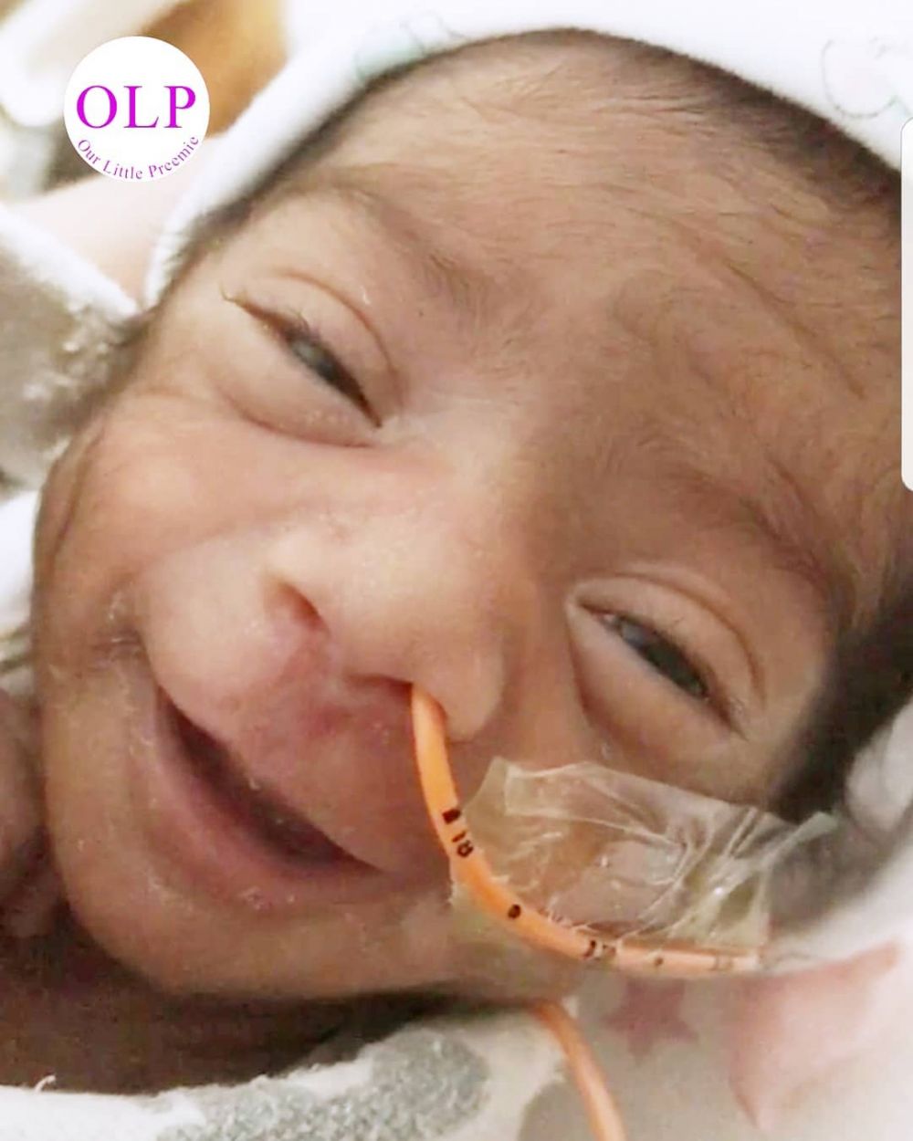 13 Potret bayi prematur yang tersenyum lebar ini bukti mereka kuat