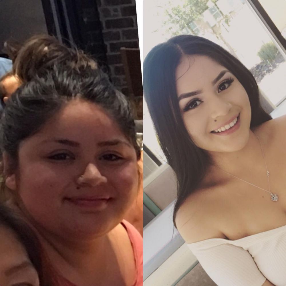 Disebut berwajah boros, perubahan gadis ini bikin melongo