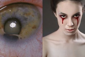 9 Masalah kesehatan mata paling mengerikan