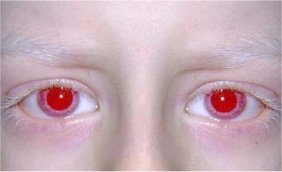 9 Masalah kesehatan mata paling mengerikan