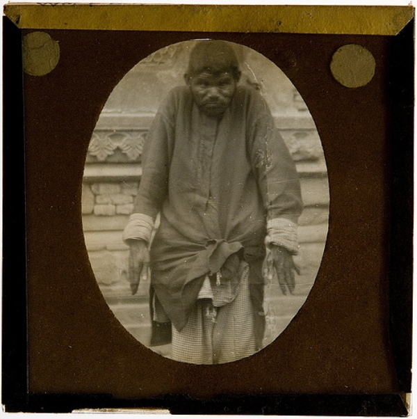 10 Kisah bocah yang hidup dan tumbuh besar dari kasih sayang binatang