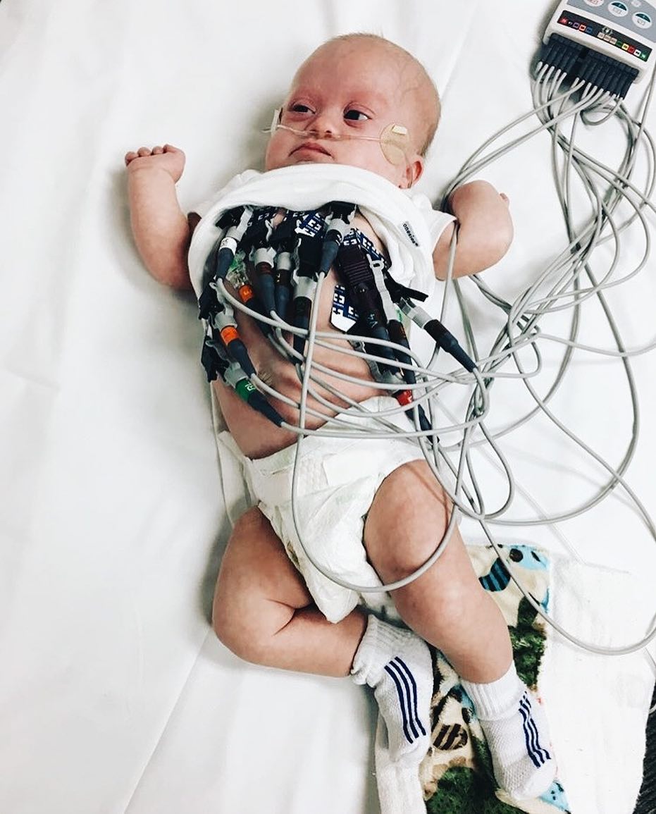 10 Potret Case, bayi penderita down syndrome yang ngegemesin banget